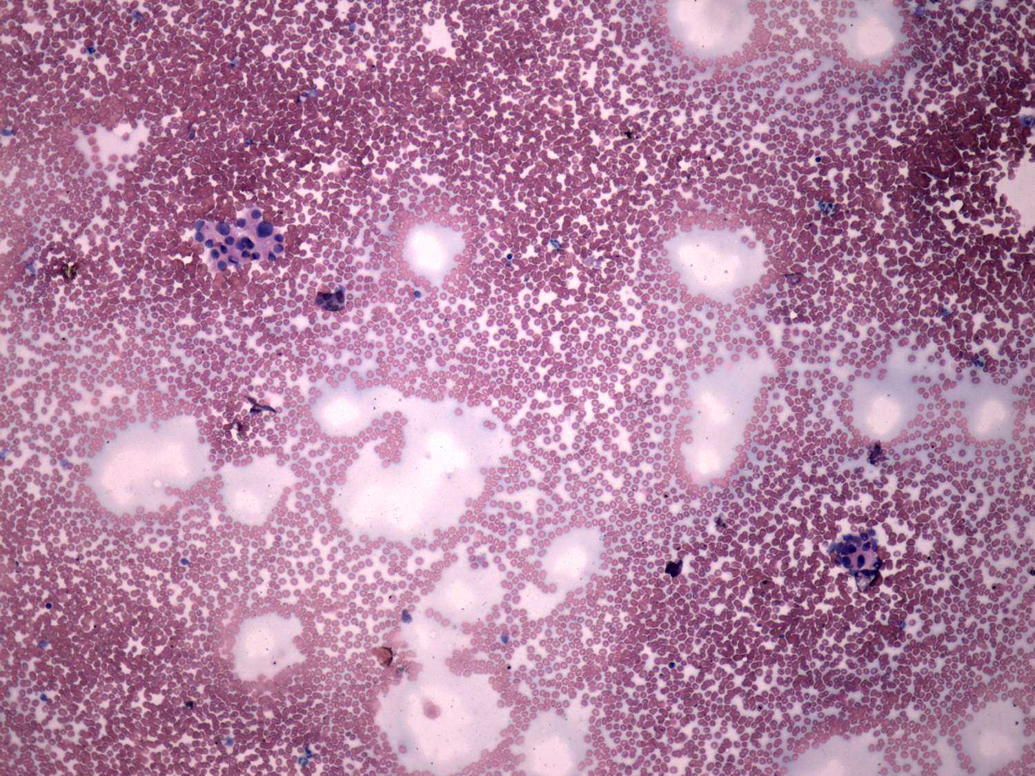 Right lobe, longitudinal scan