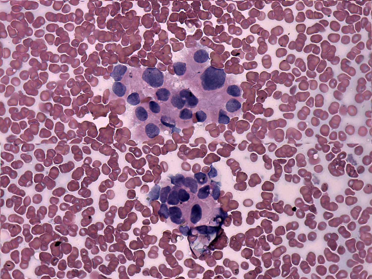 Right lobe, longitudinal scan