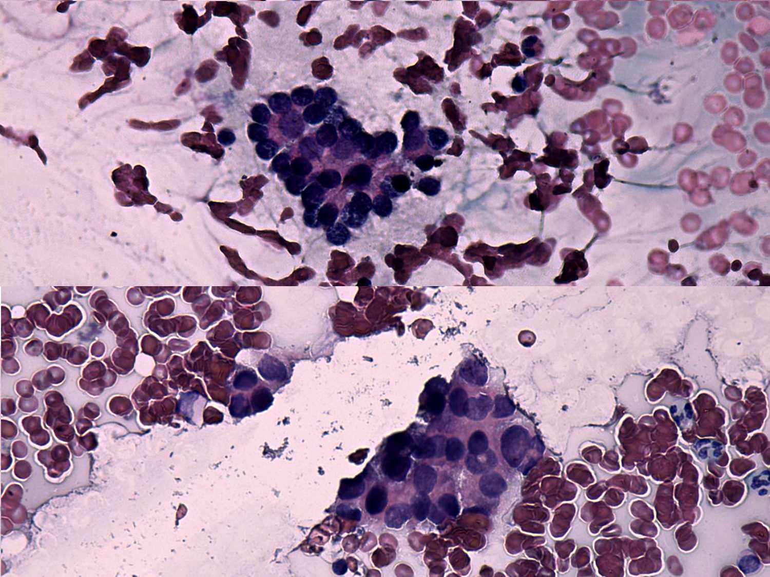 Right lobe, longitudinal scan