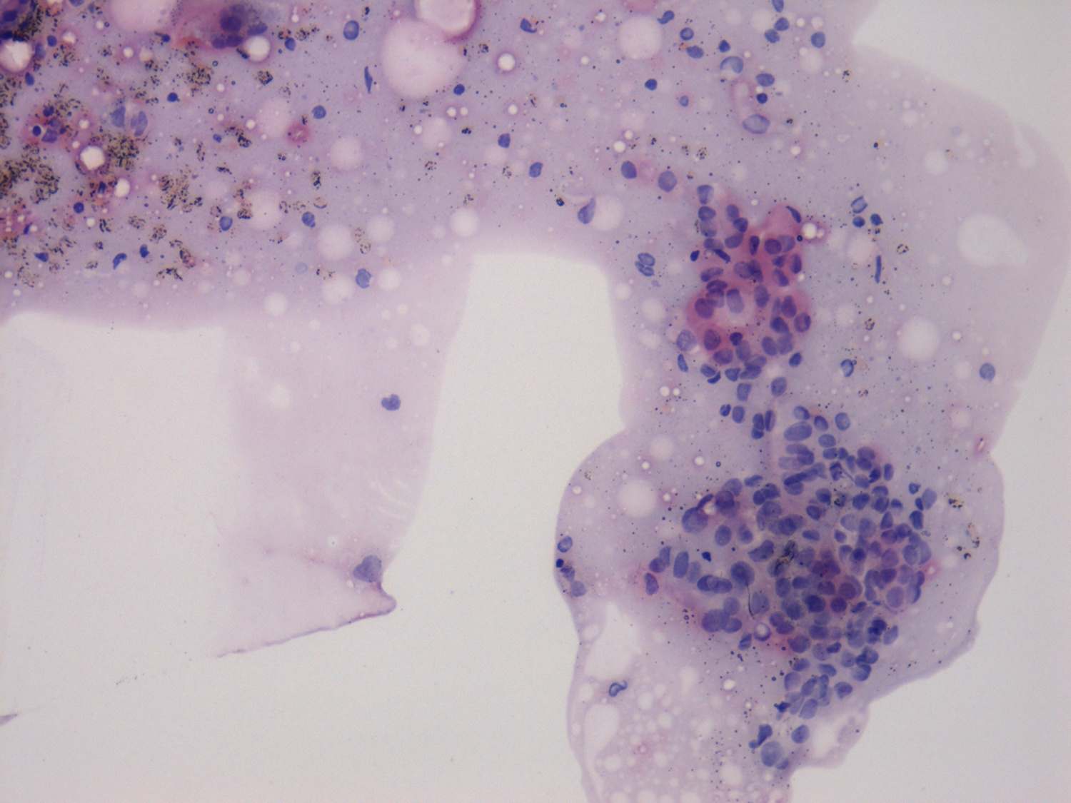 Right lobe, longitudinal scan