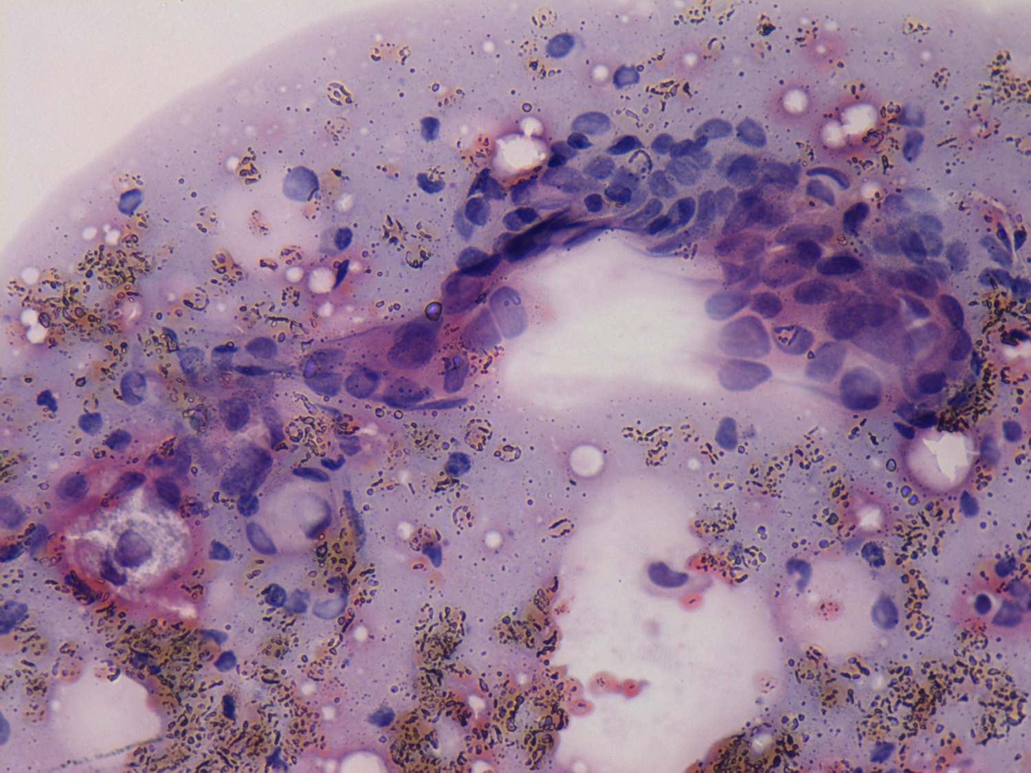 Right lobe, longitudinal scan