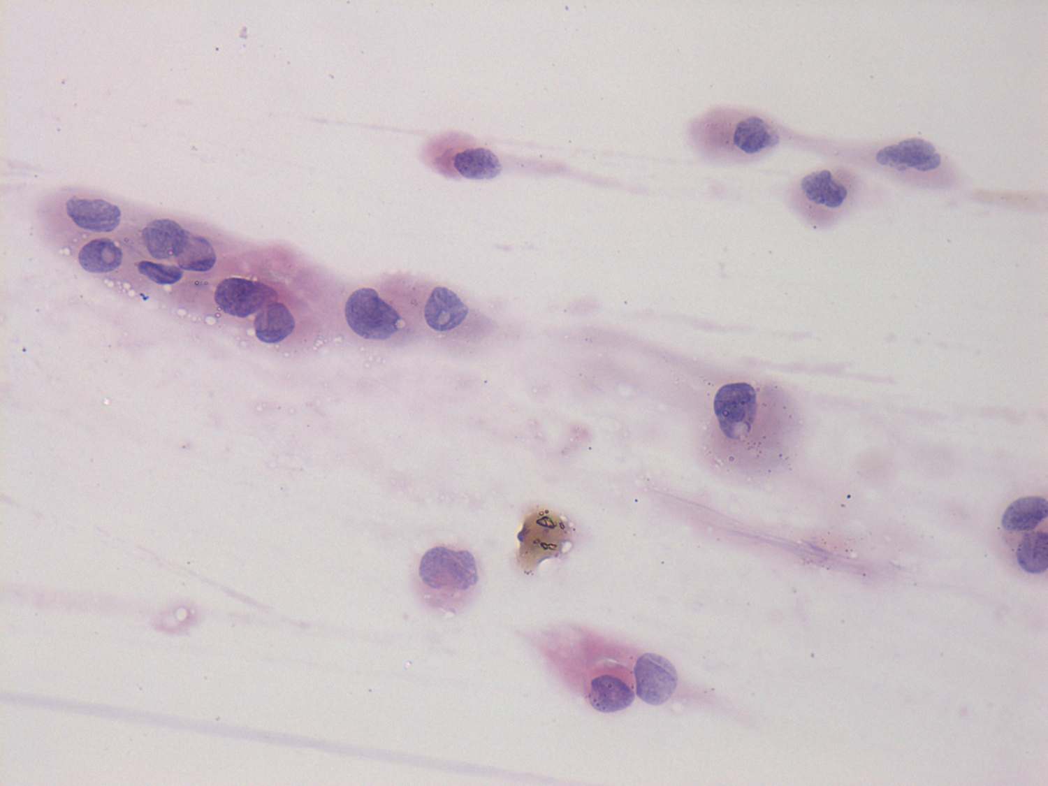 Right lobe, longitudinal scan
