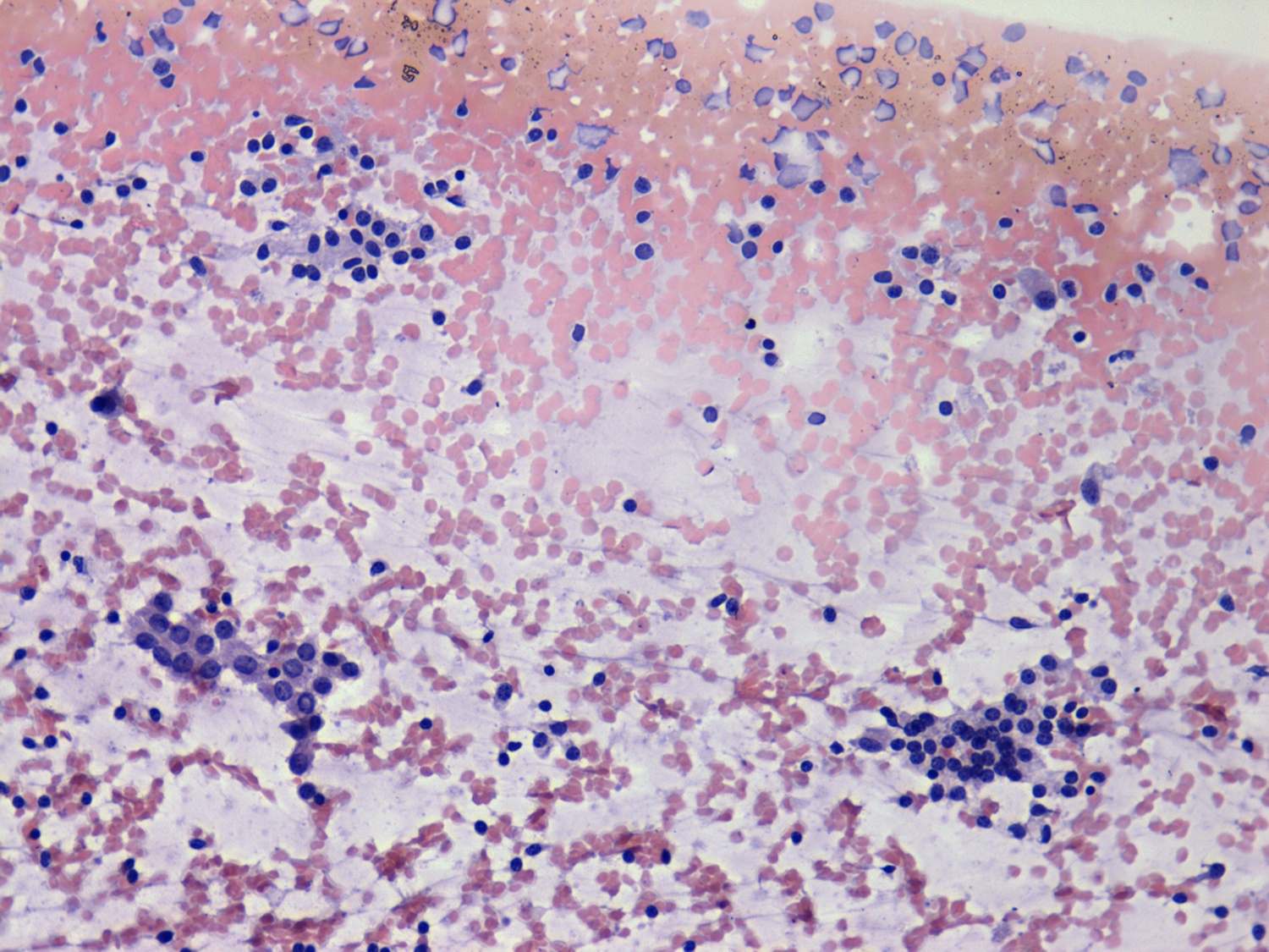 Right lobe, longitudinal scan