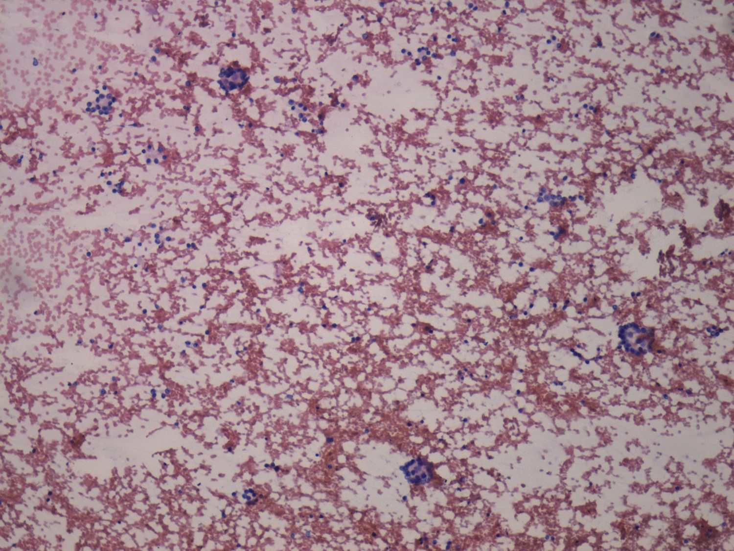 Right lobe, longitudinal scan
