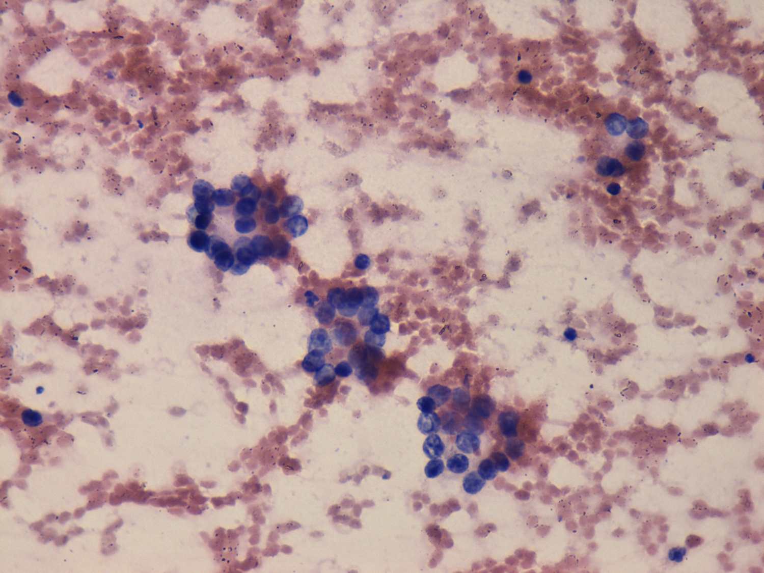 Right lobe, longitudinal scan