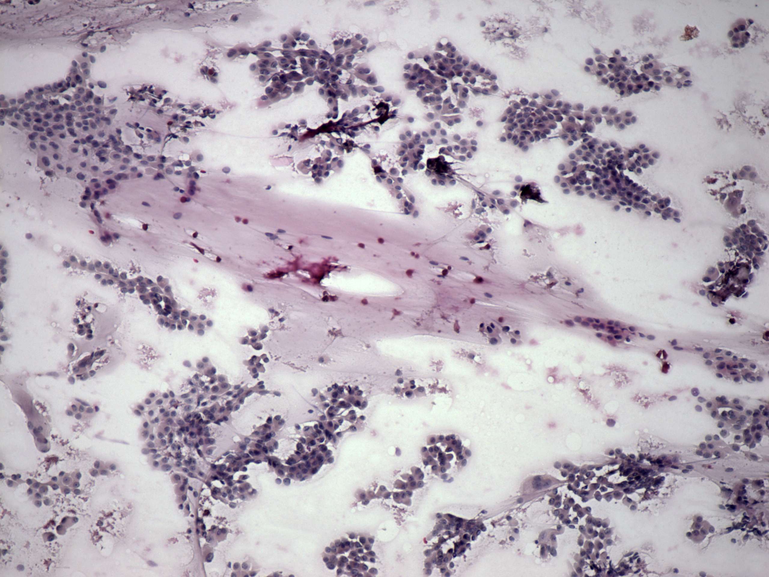 Right lobe, longitudinal scan
