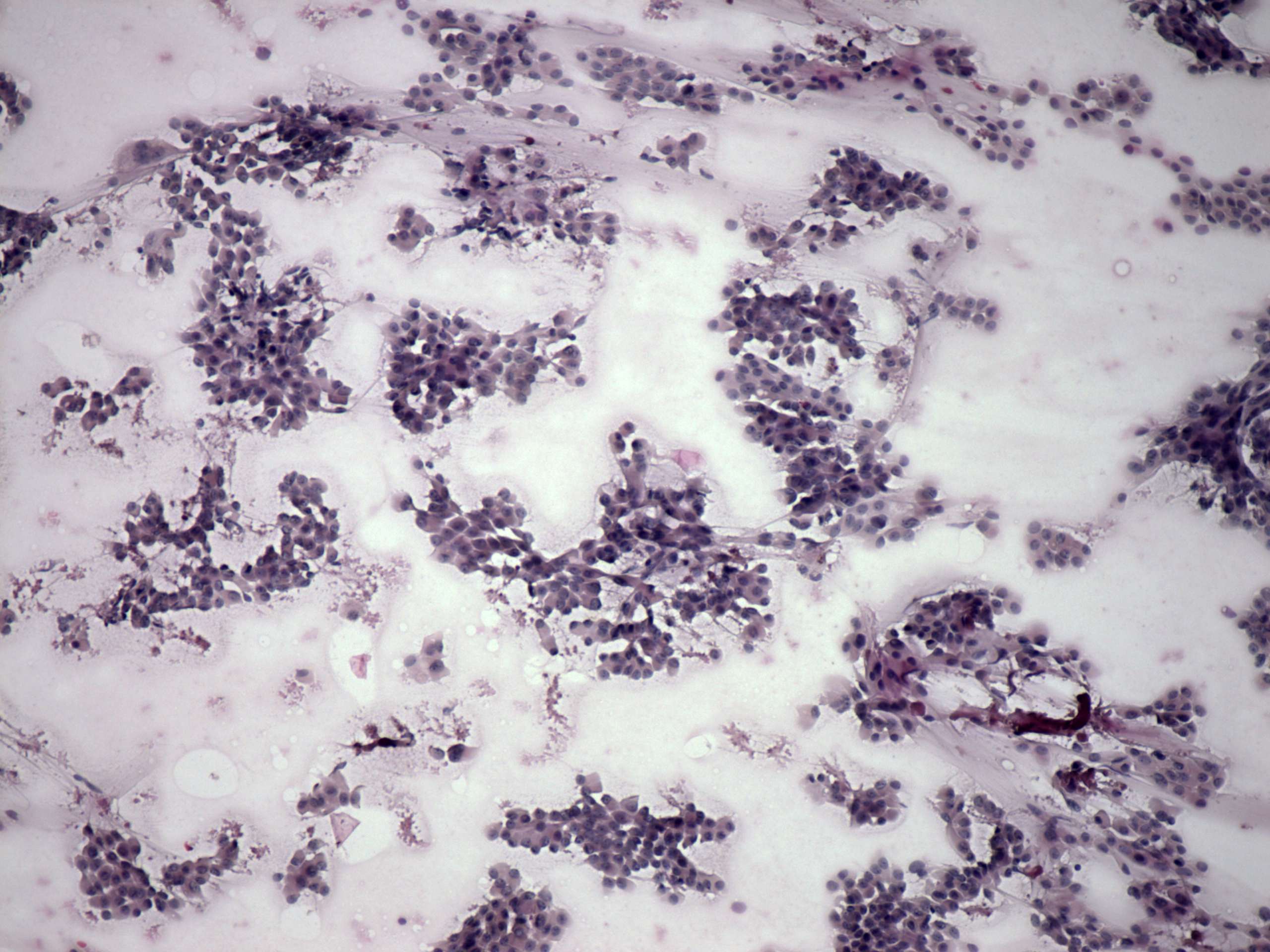 Right lobe, longitudinal scan