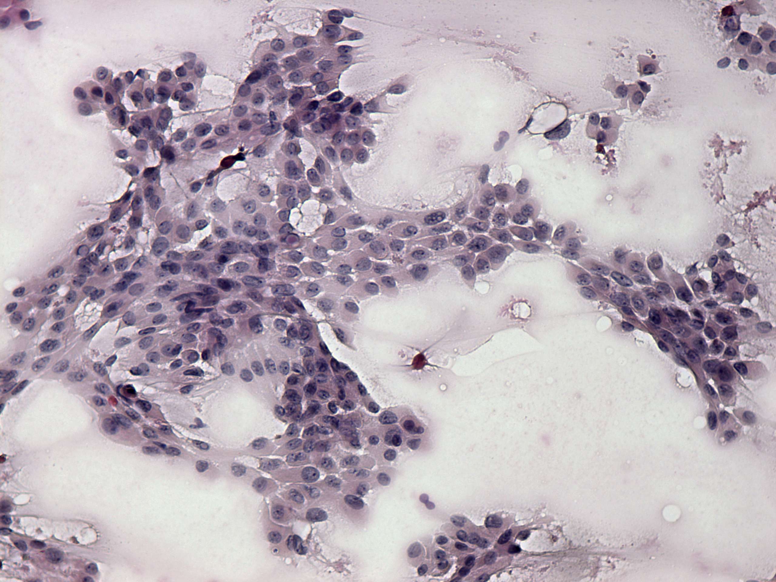 Right lobe, longitudinal scan