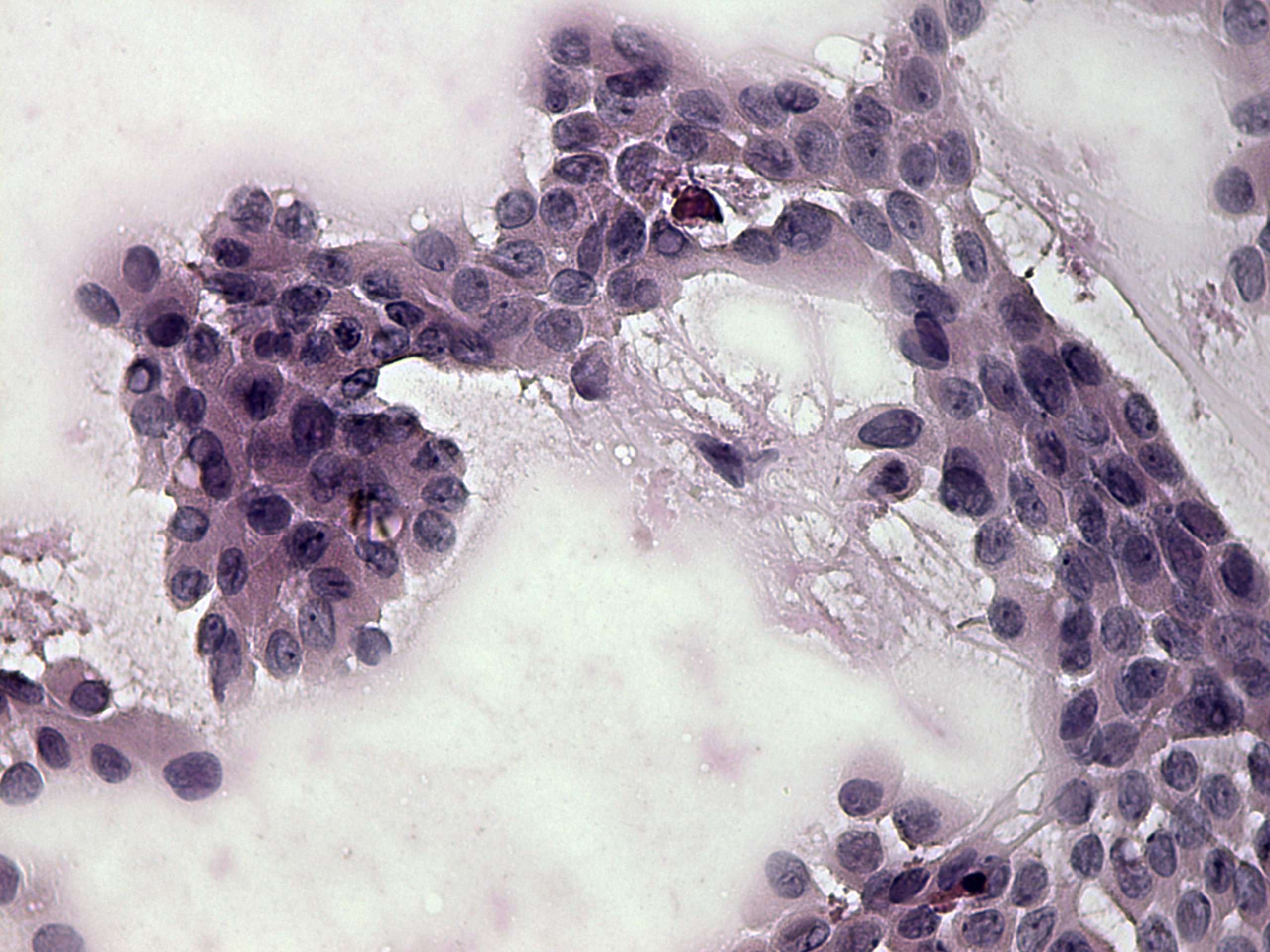 Right lobe, longitudinal scan