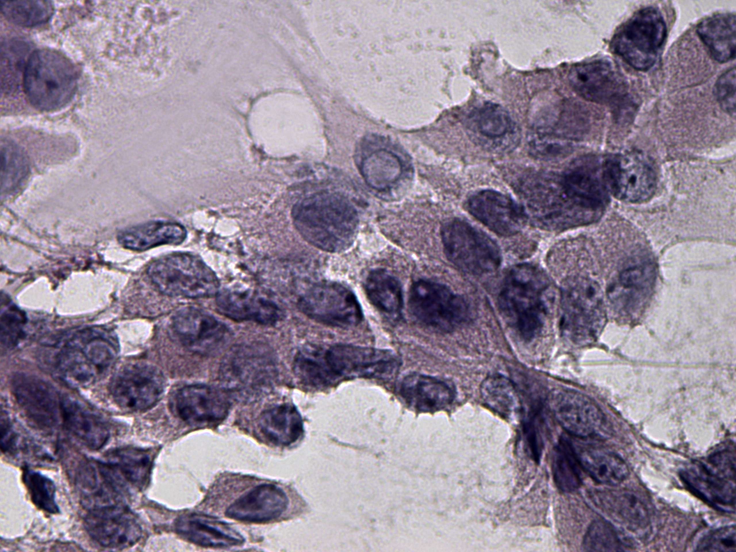 Right lobe, longitudinal scan
