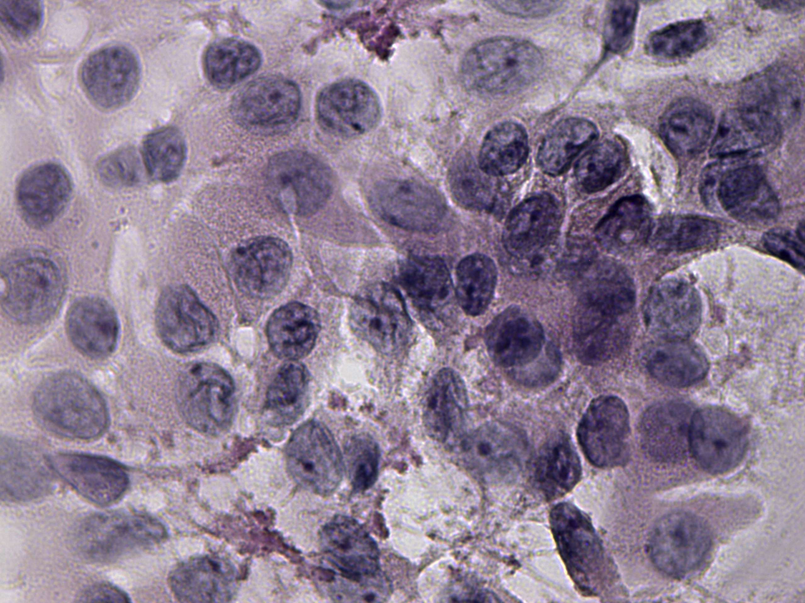 Right lobe, longitudinal scan