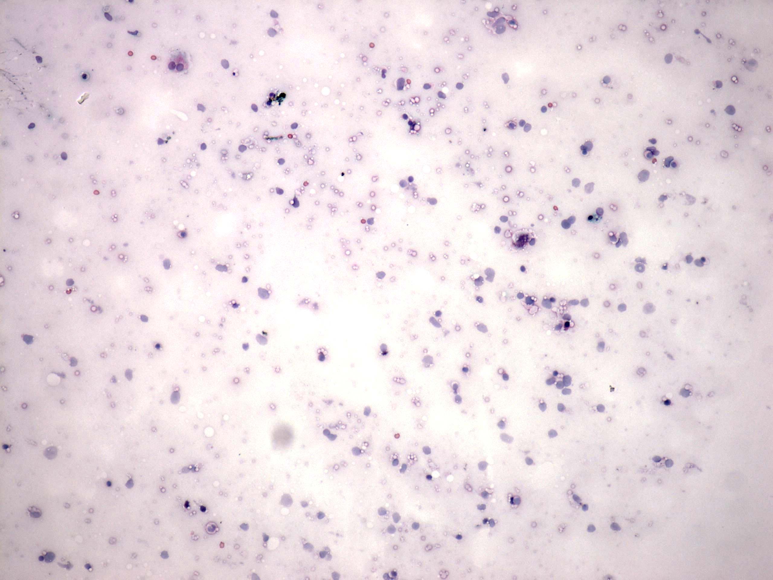 Right lobe, longitudinal scan