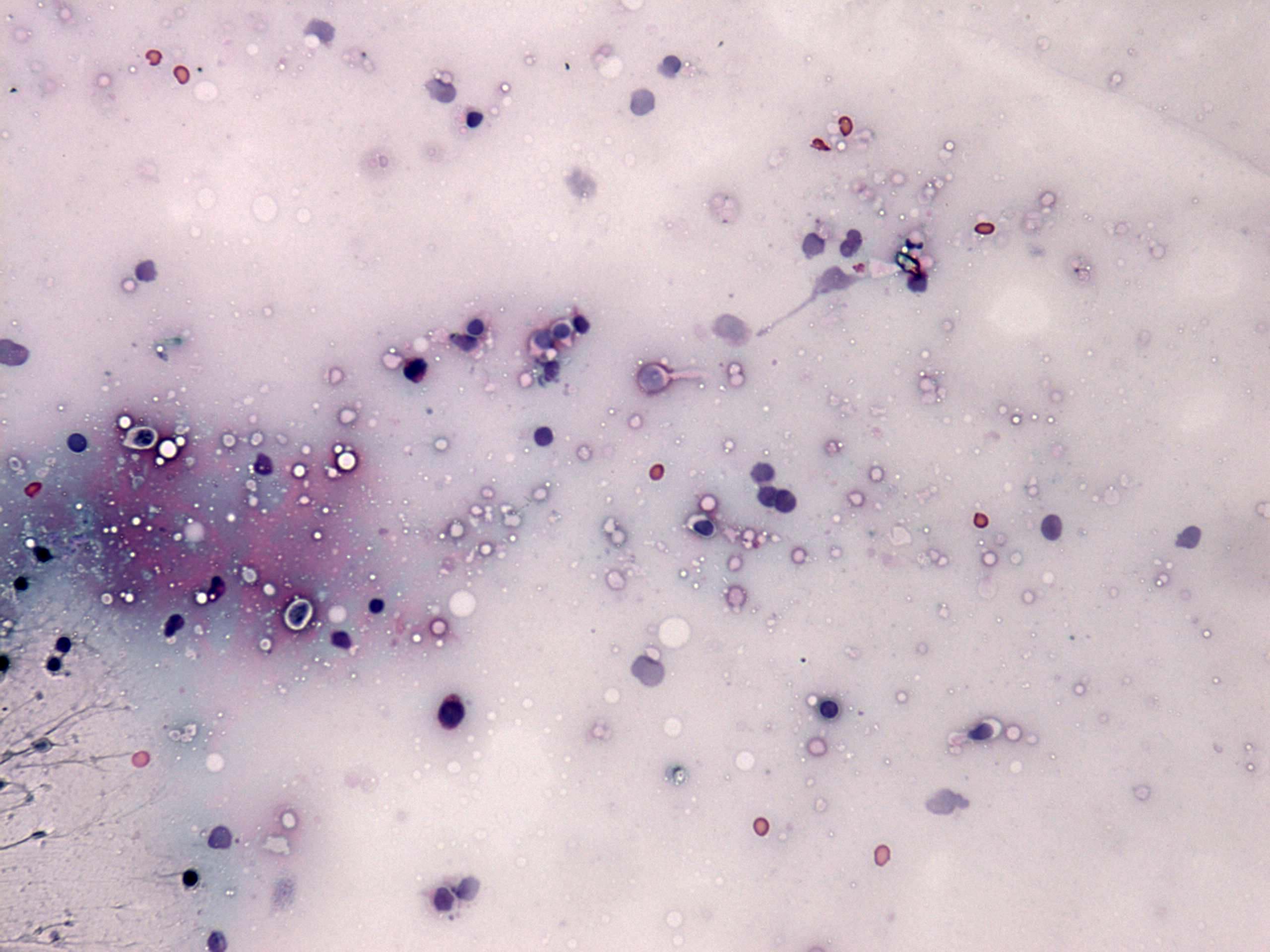 Right lobe, longitudinal scan