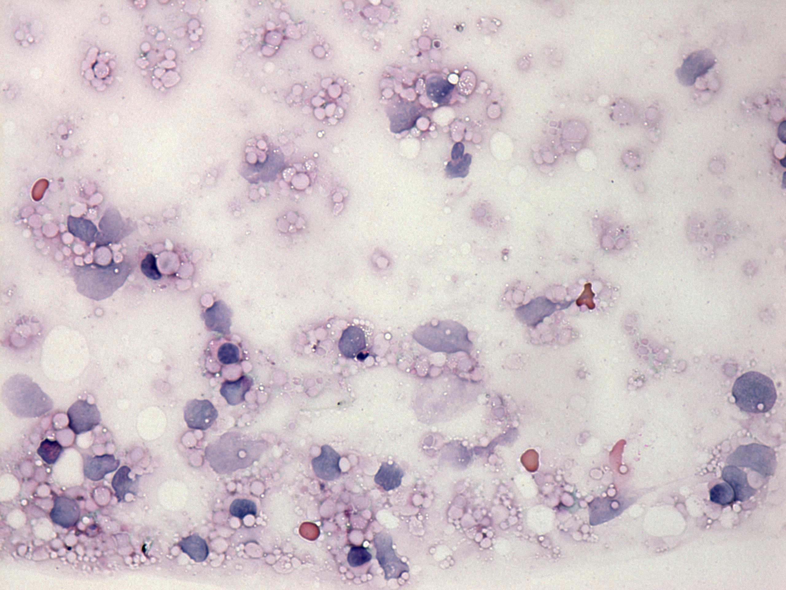 Right lobe, longitudinal scan