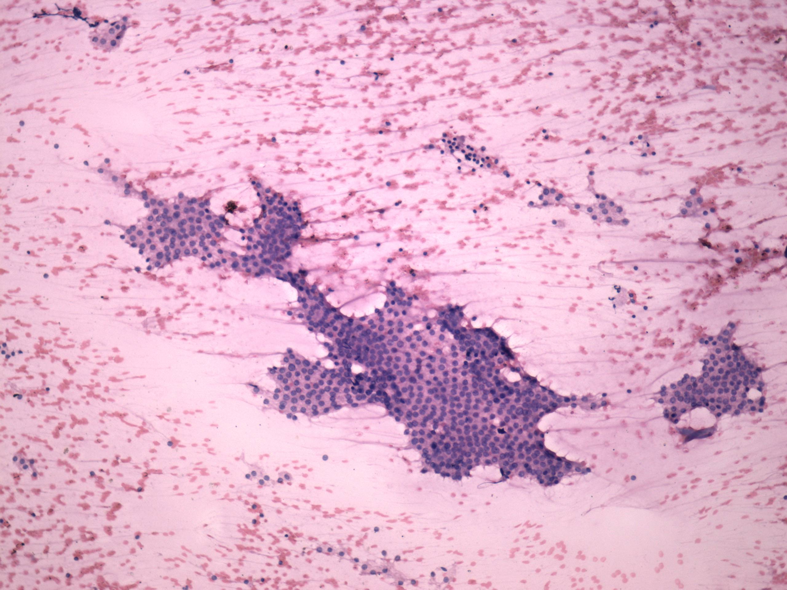 Right lobe, longitudinal scan