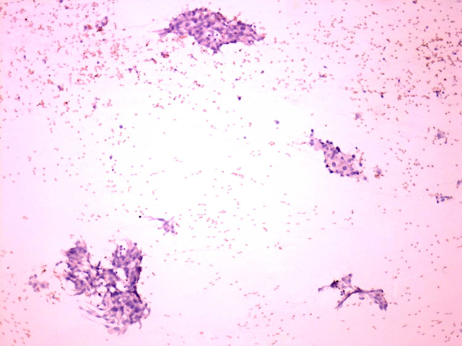 Right lobe, longitudinal scan
