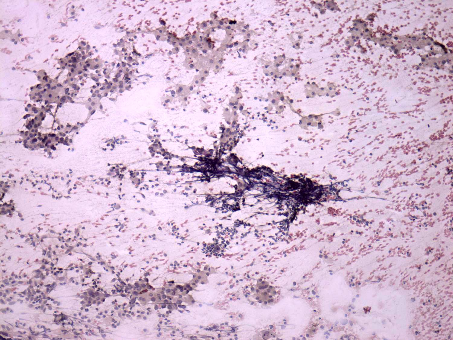 Right lobe, longitudinal scan