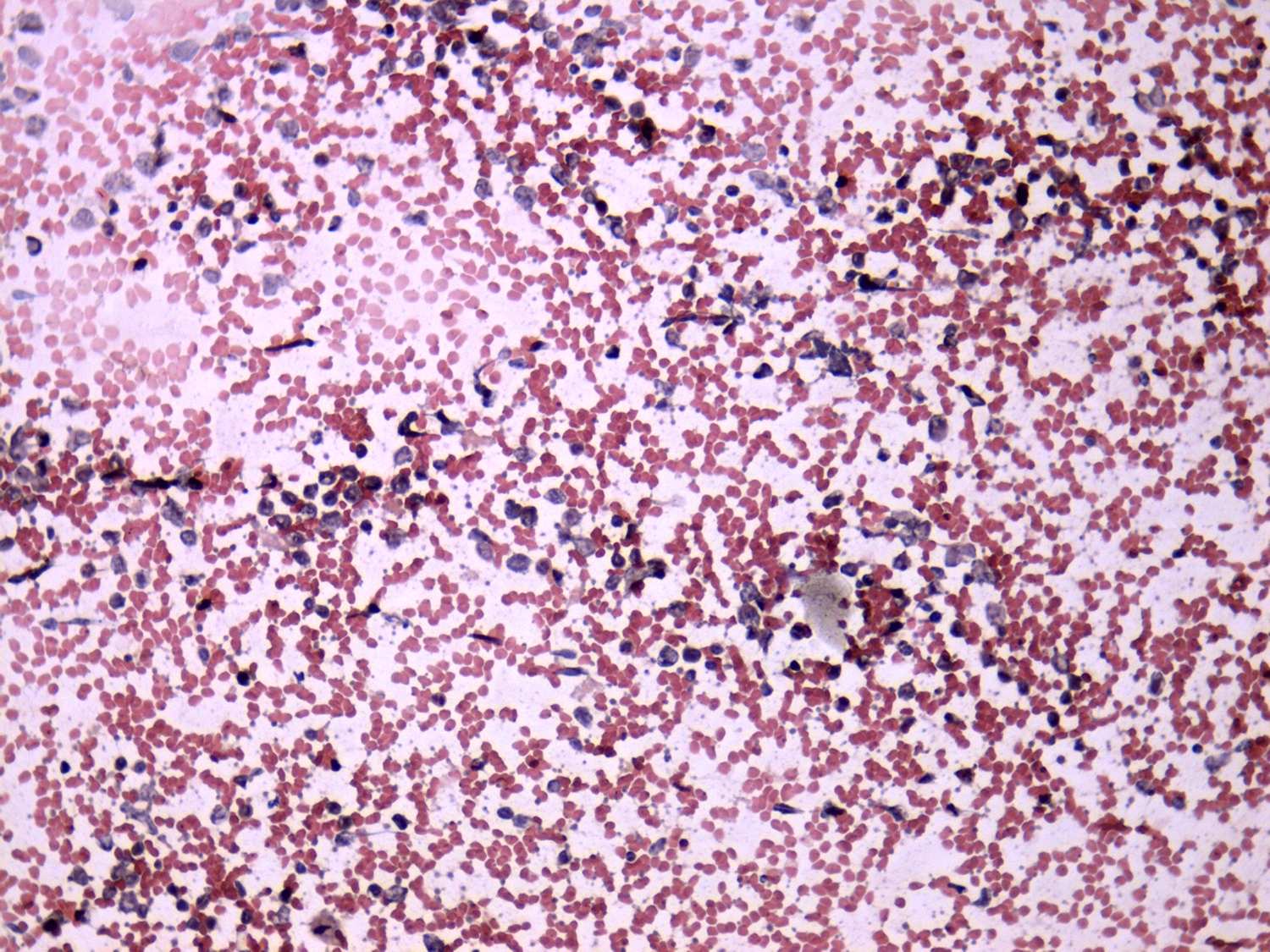Right lobe, longitudinal scan