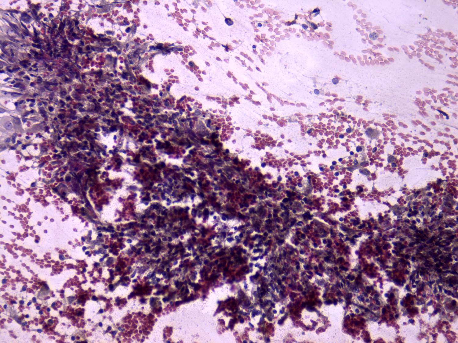 Right lobe, longitudinal scan