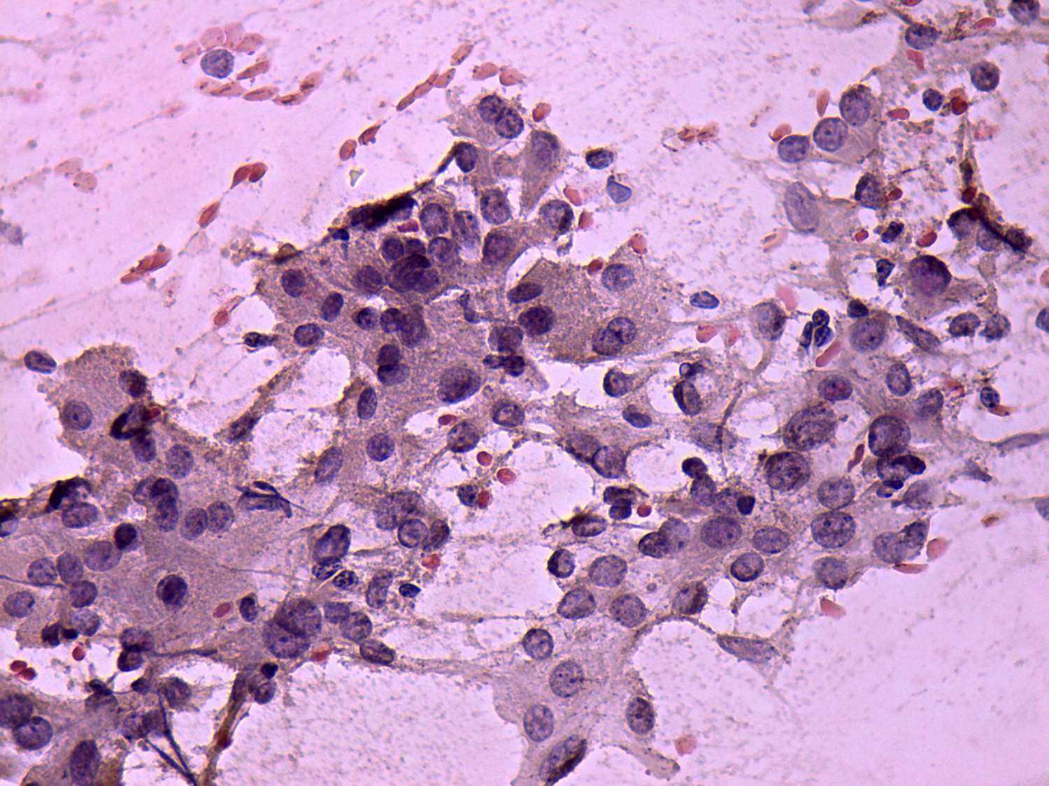 Right lobe, longitudinal scan