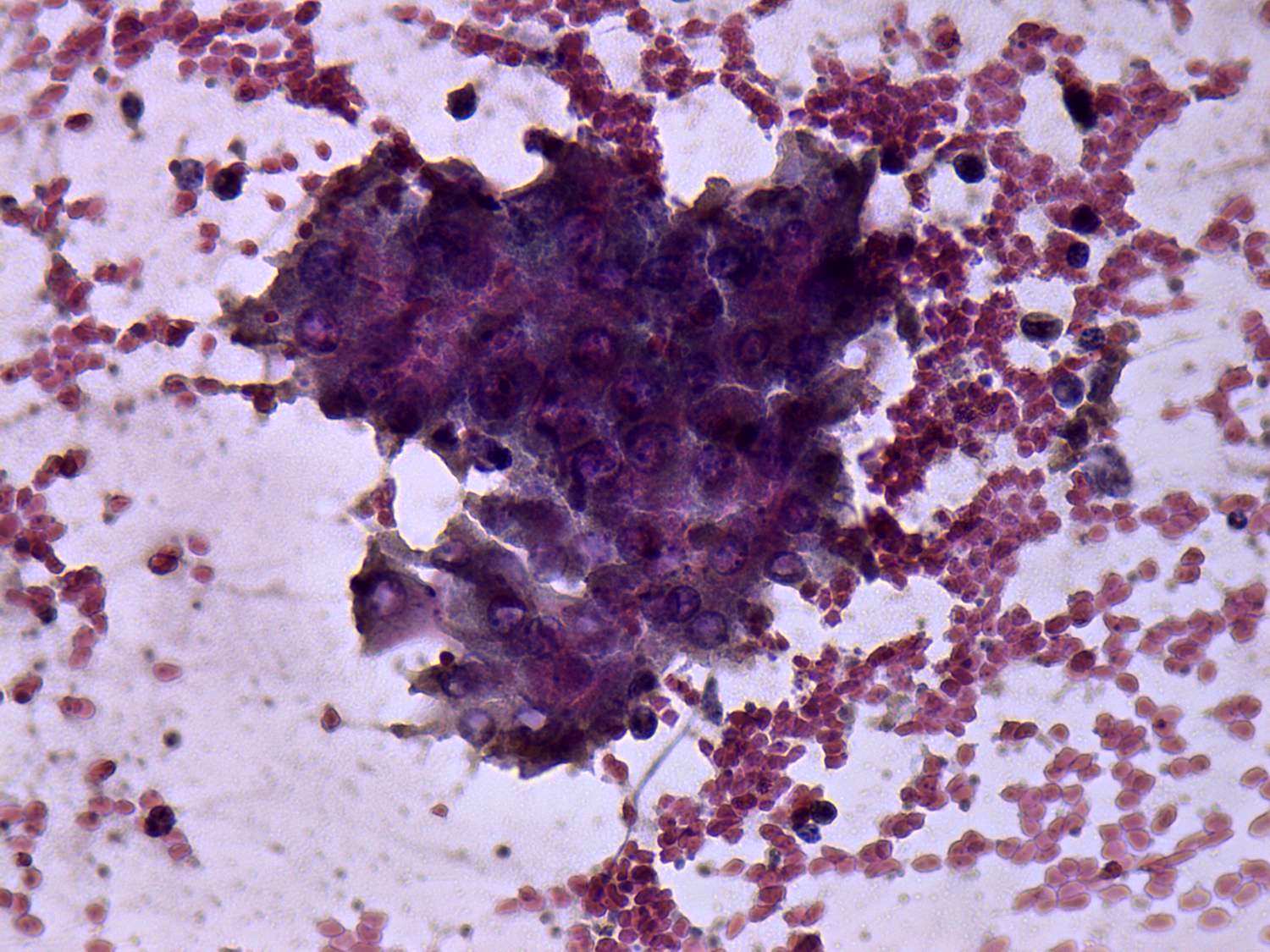 Right lobe, longitudinal scan