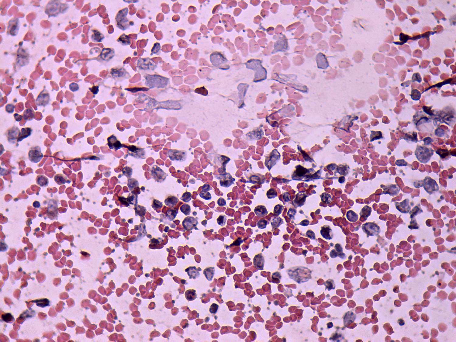 Right lobe, longitudinal scan