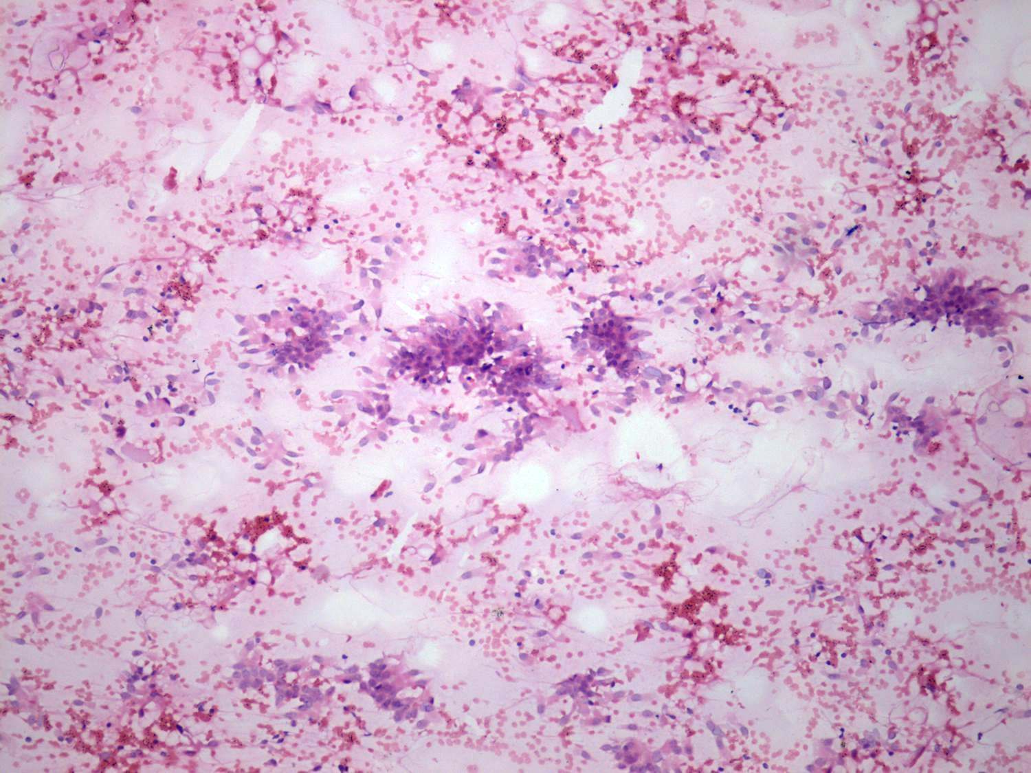Right lobe, longitudinal scan