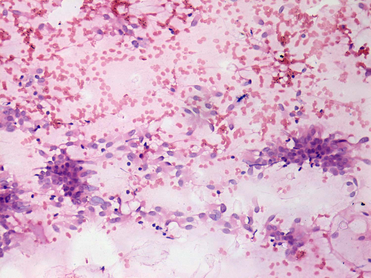 Right lobe, longitudinal scan