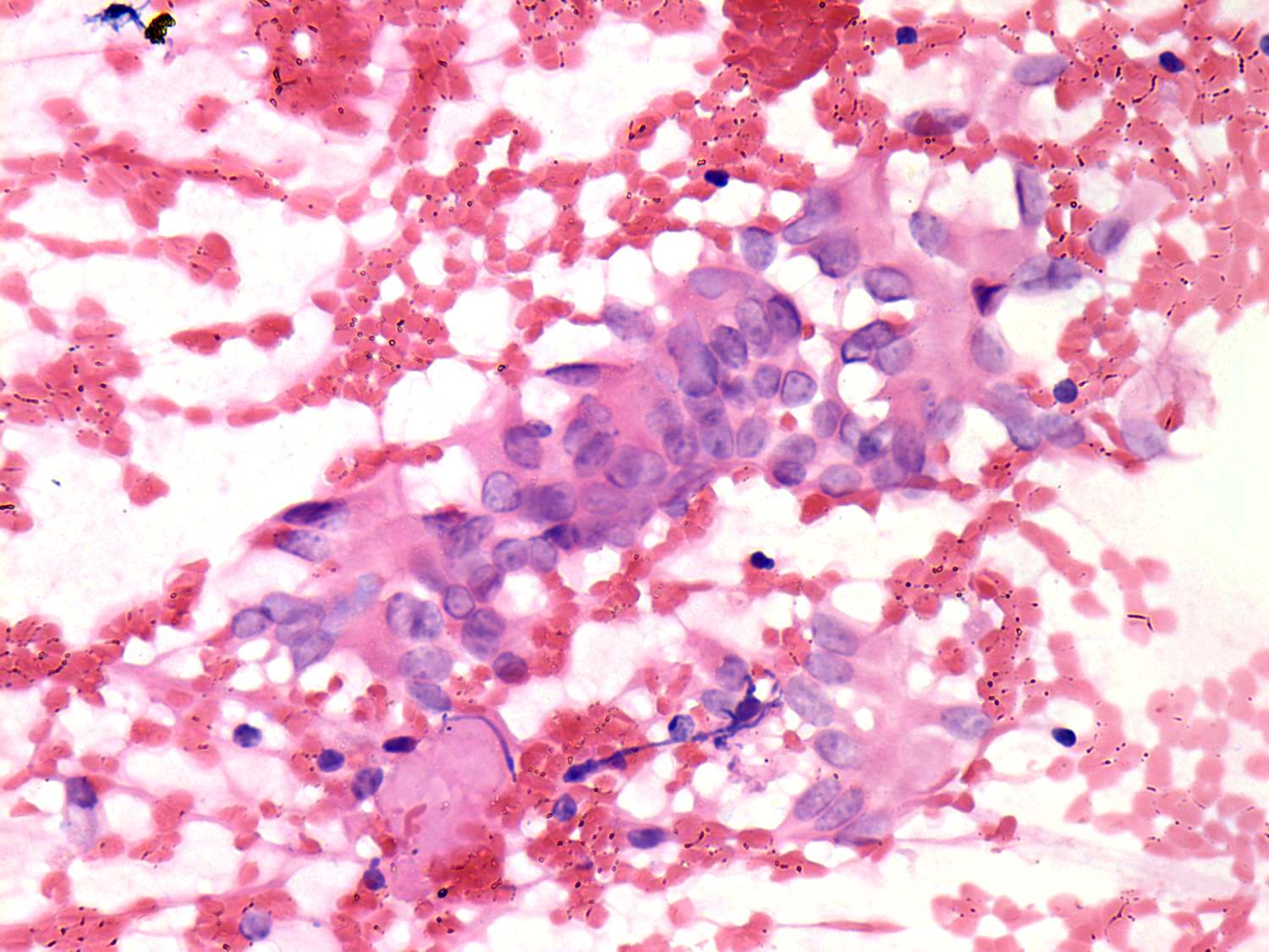 Right lobe, longitudinal scan