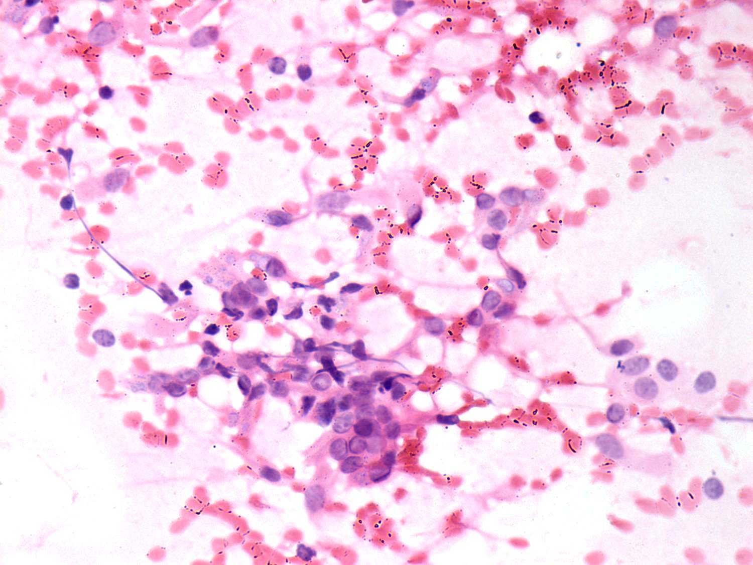 Right lobe, longitudinal scan