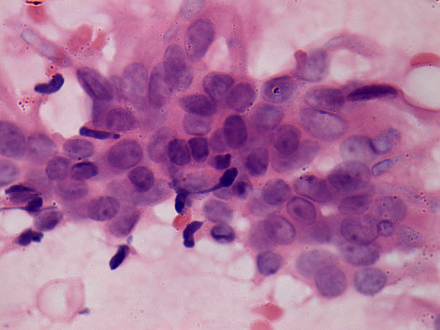 Right lobe, longitudinal scan
