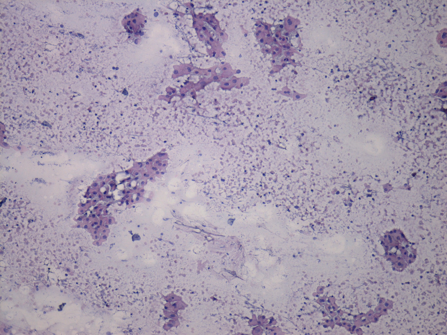 Right lobe, longitudinal scan