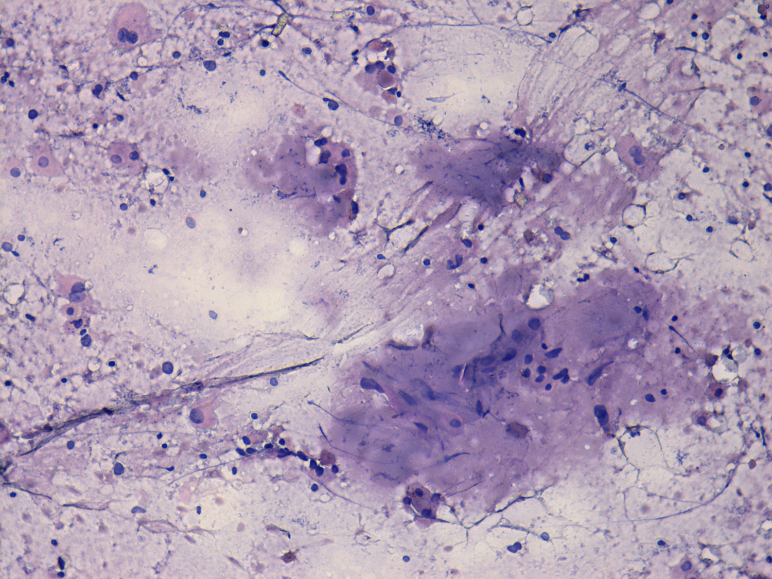 Right lobe, longitudinal scan
