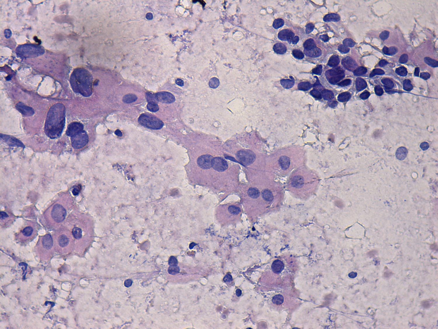 Right lobe, longitudinal scan