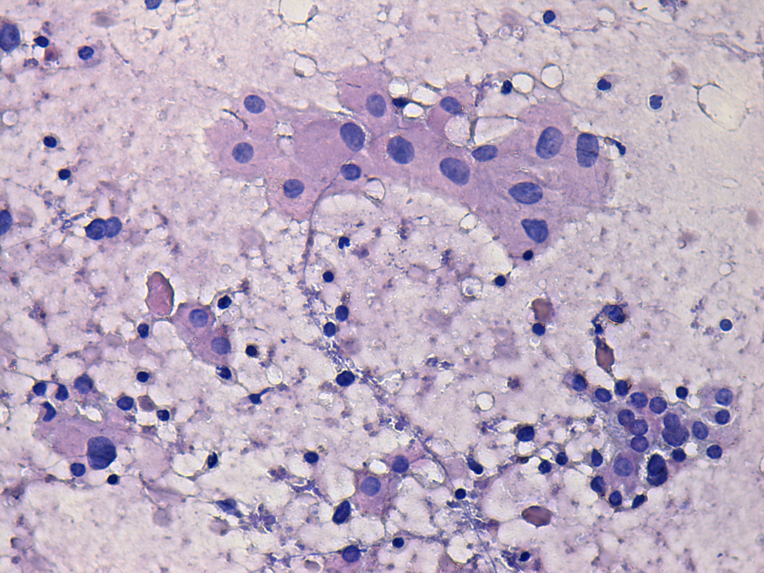 Right lobe, longitudinal scan