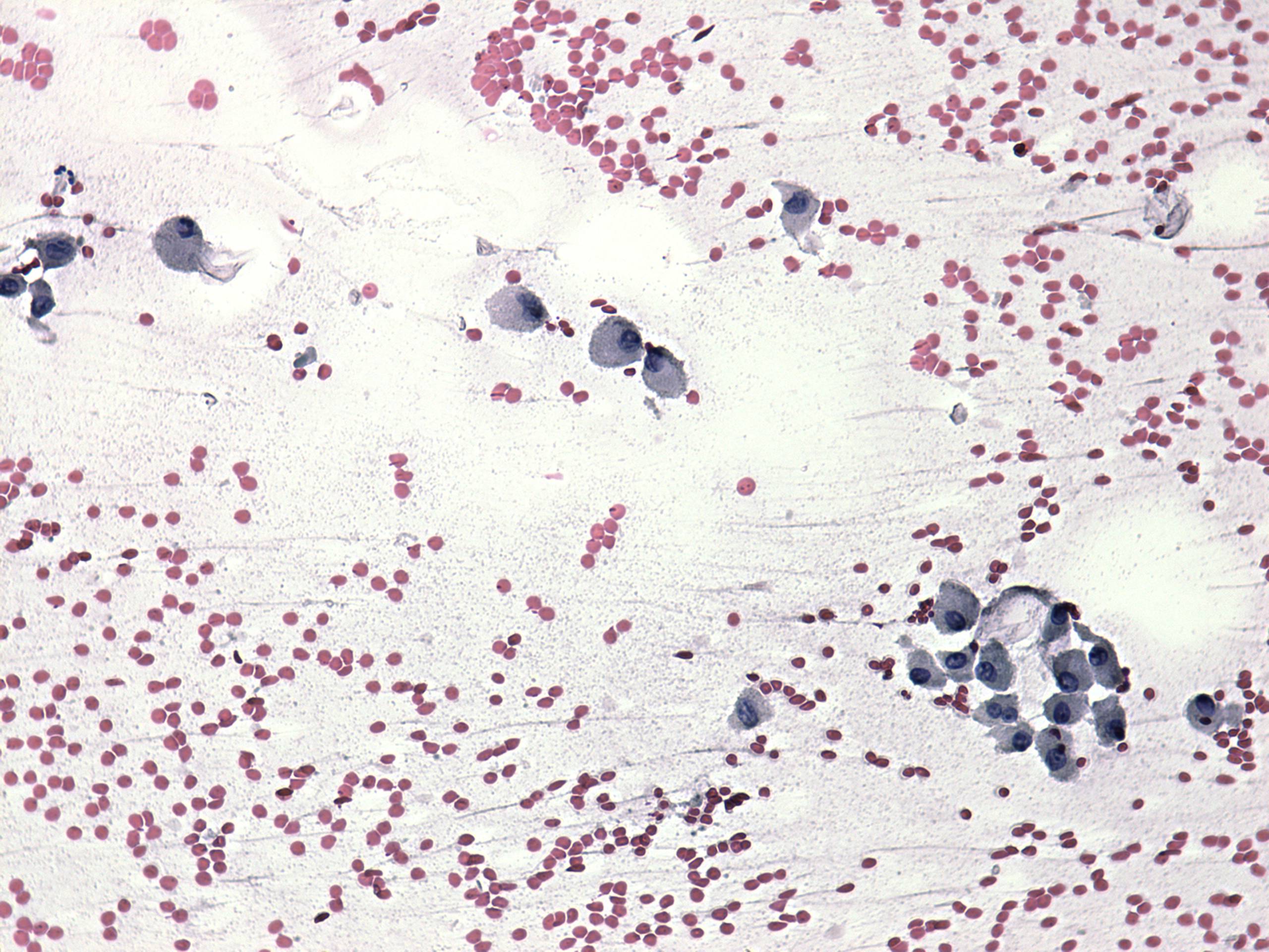 Right lobe, longitudinal scan