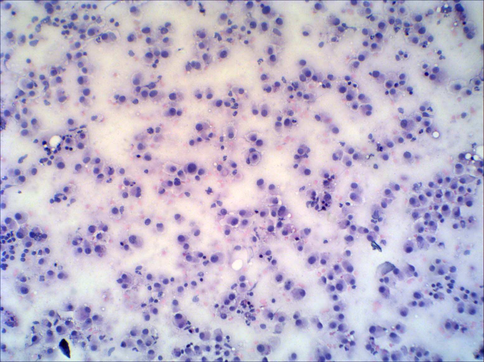 Right lobe, longitudinal scan