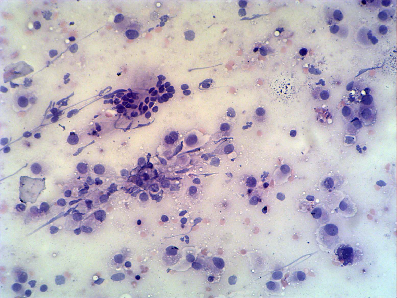 Right lobe, longitudinal scan