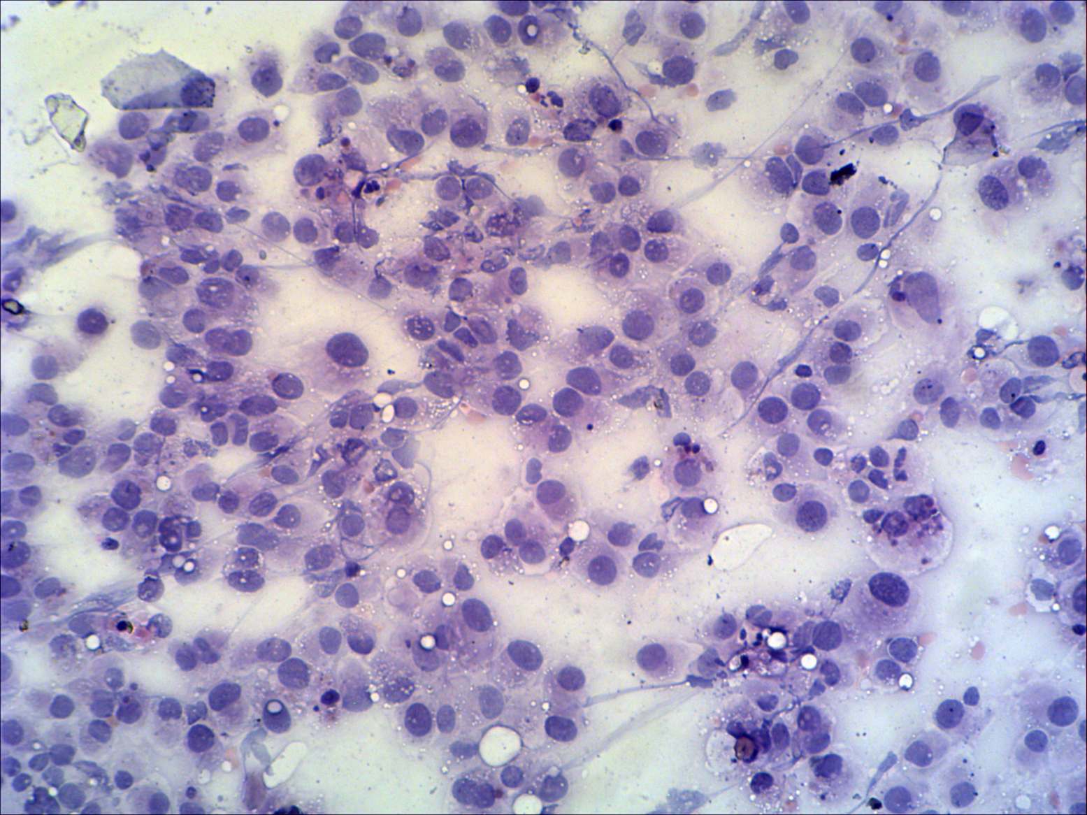 Right lobe, longitudinal scan