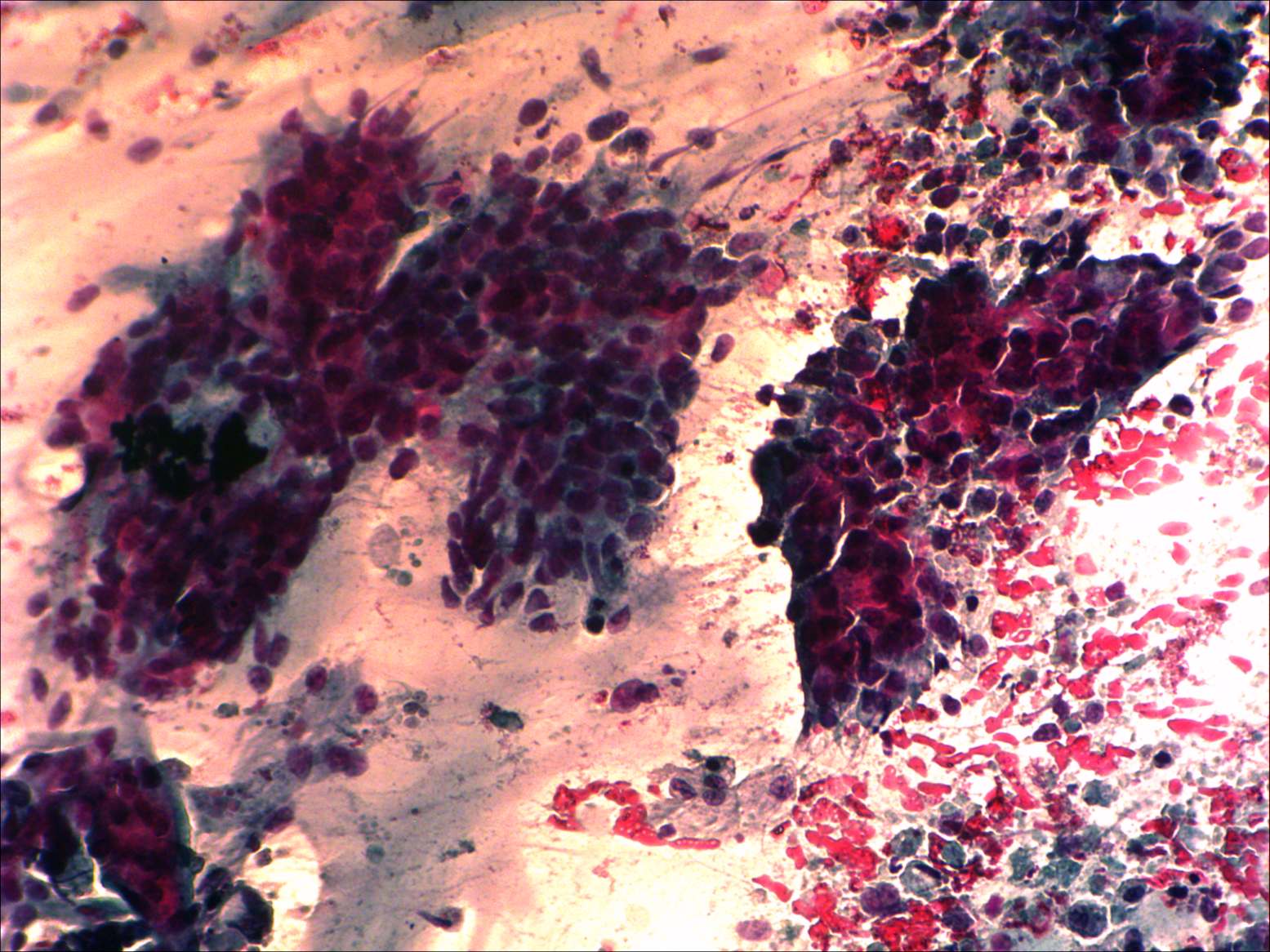 Right lobe, longitudinal scan