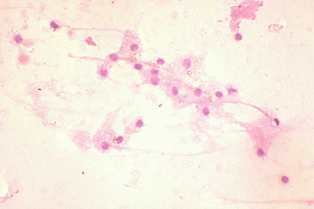 Right lobe, longitudinal scan