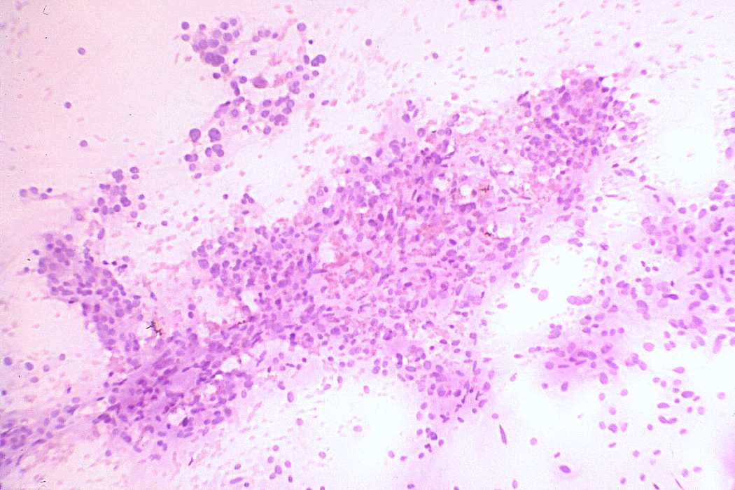 Right lobe, longitudinal scan