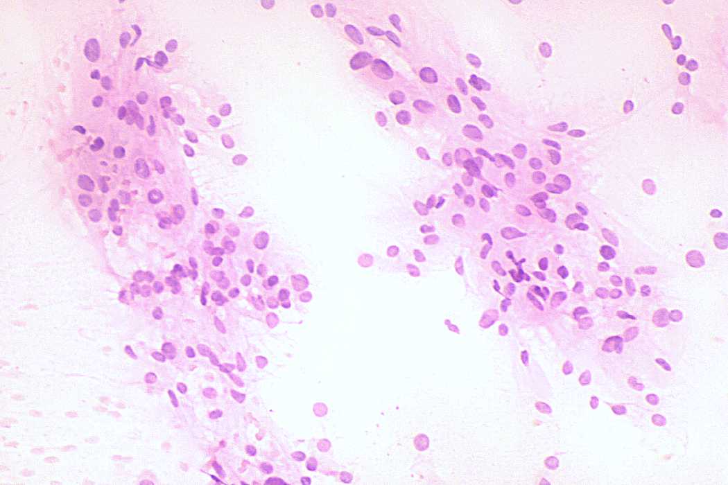 Right lobe, longitudinal scan