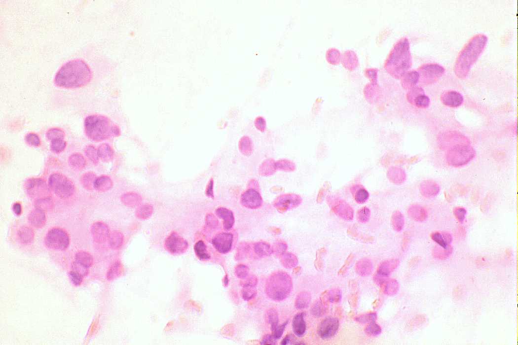 Right lobe, longitudinal scan