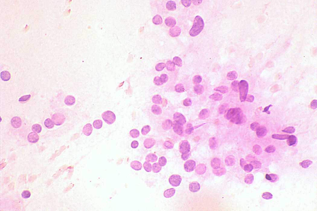 Right lobe, longitudinal scan
