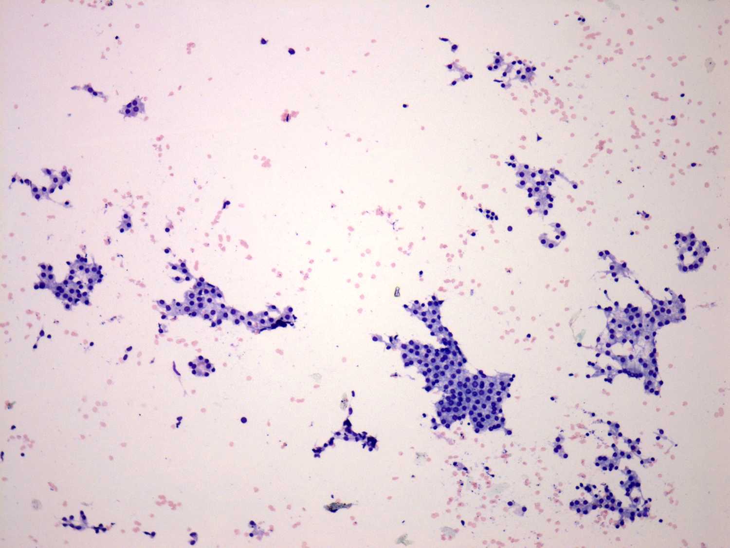 Right lobe, longitudinal scan