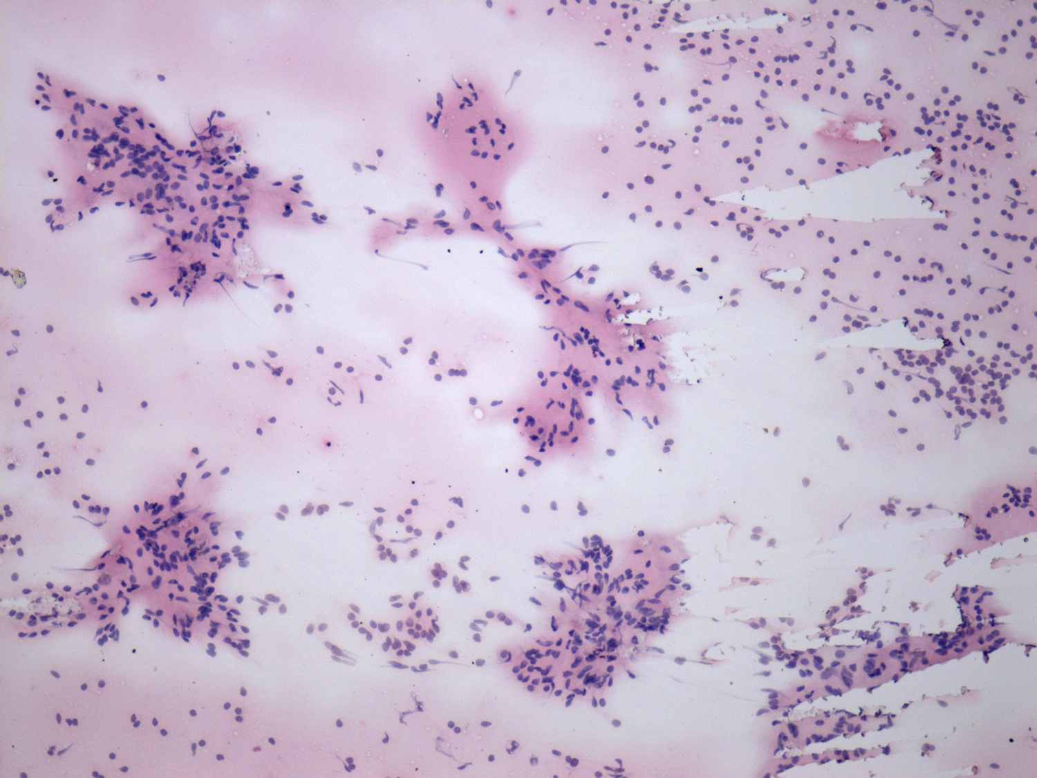 Right lobe, longitudinal scan