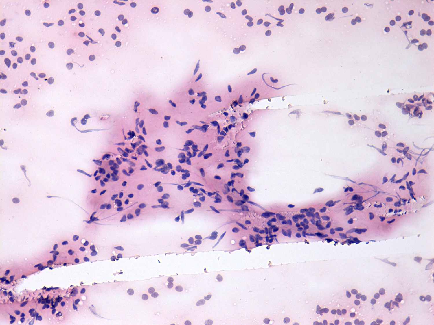 Right lobe, longitudinal scan