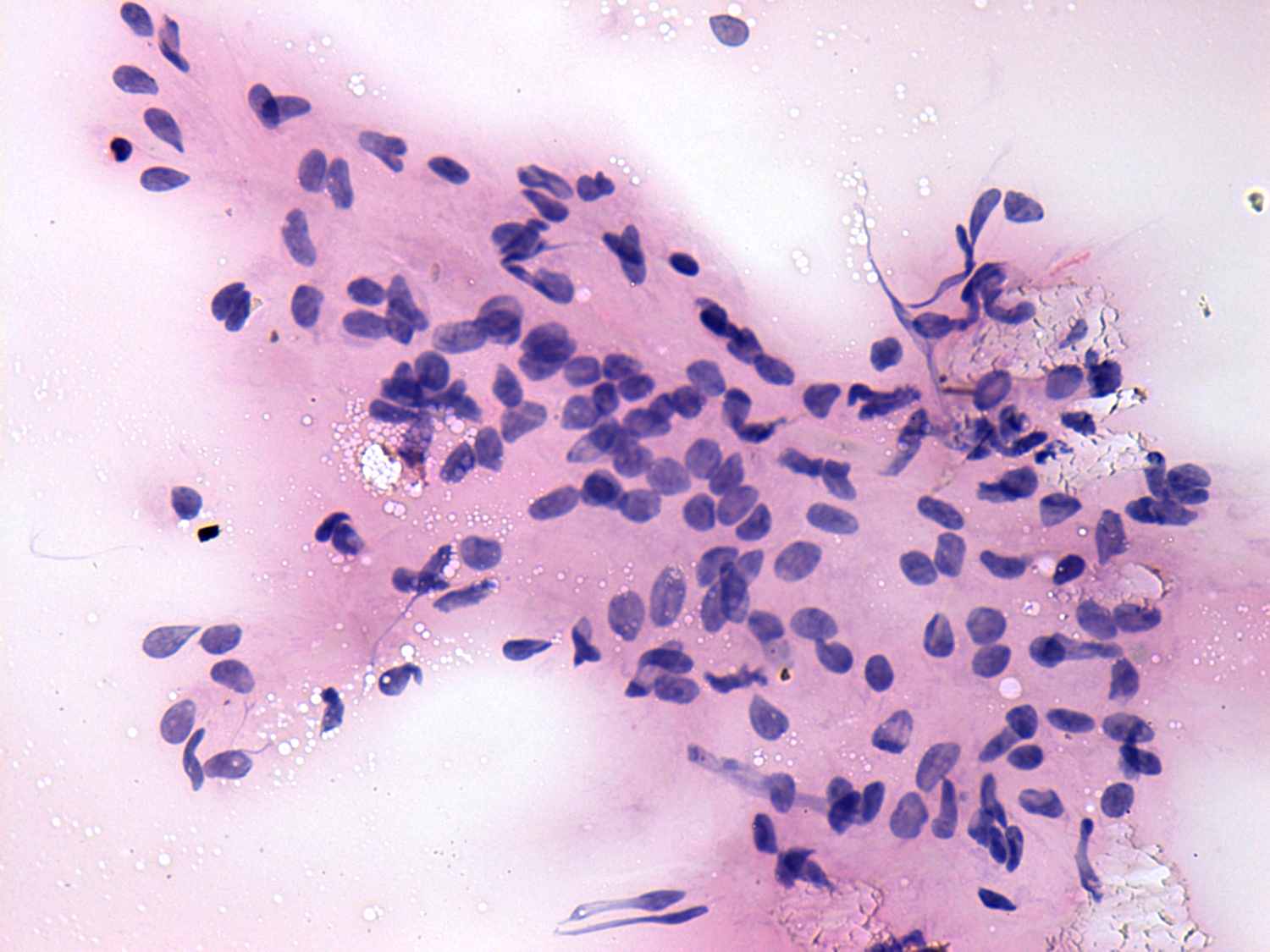 Right lobe, longitudinal scan