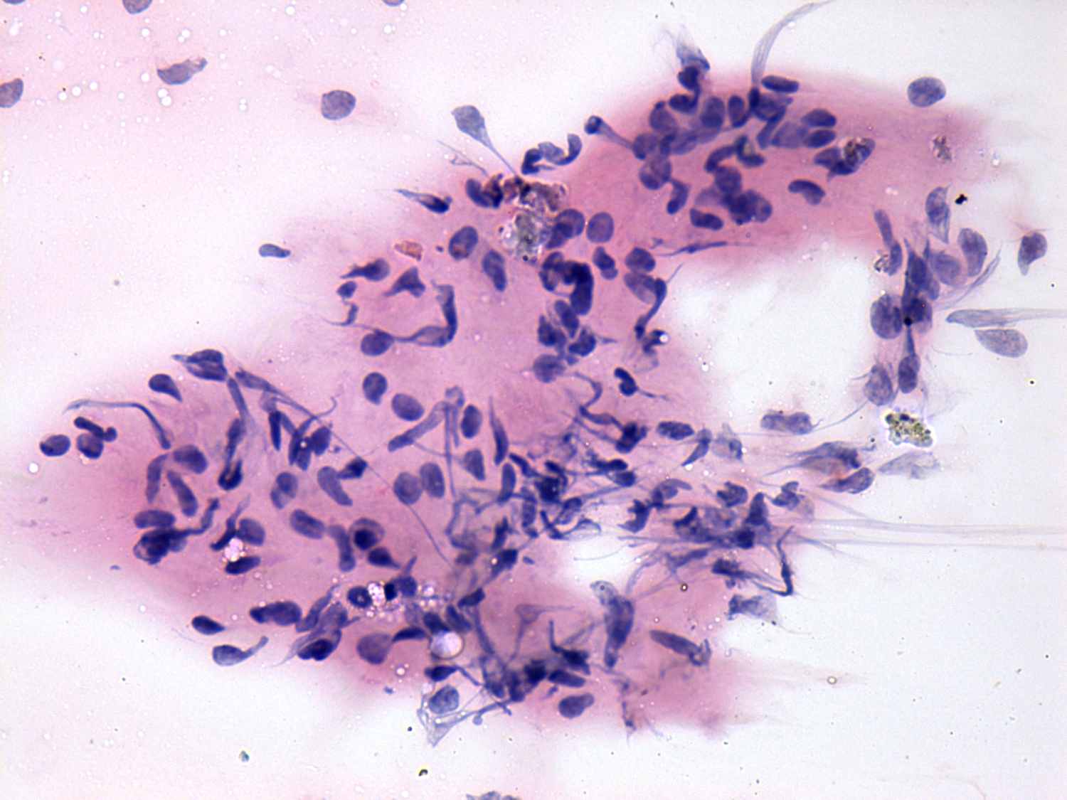 Right lobe, longitudinal scan